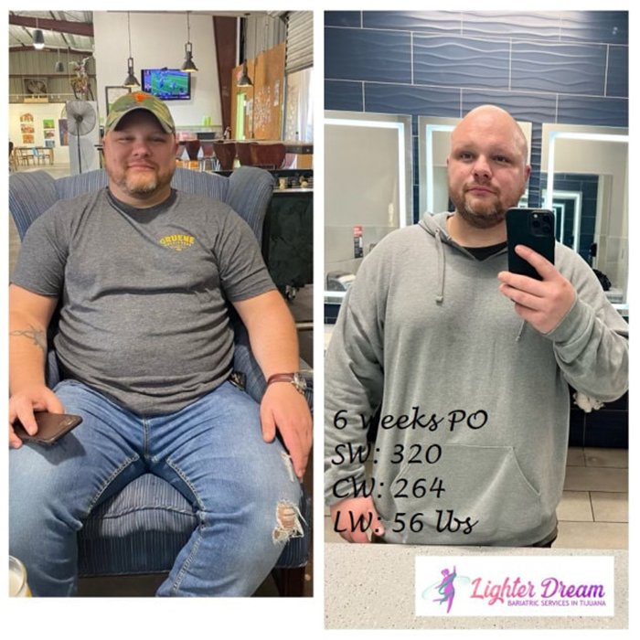 56 lbs Lost in 6 Weeks