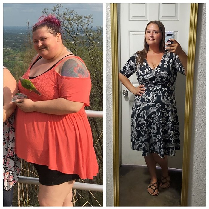 Gastric Sleeve Success